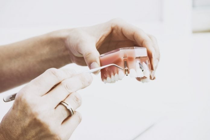 dovod-na-usmev-chyba-mi-zub-su-pre-mna-vhodne-zubne-implantaty-zubna-nahrada